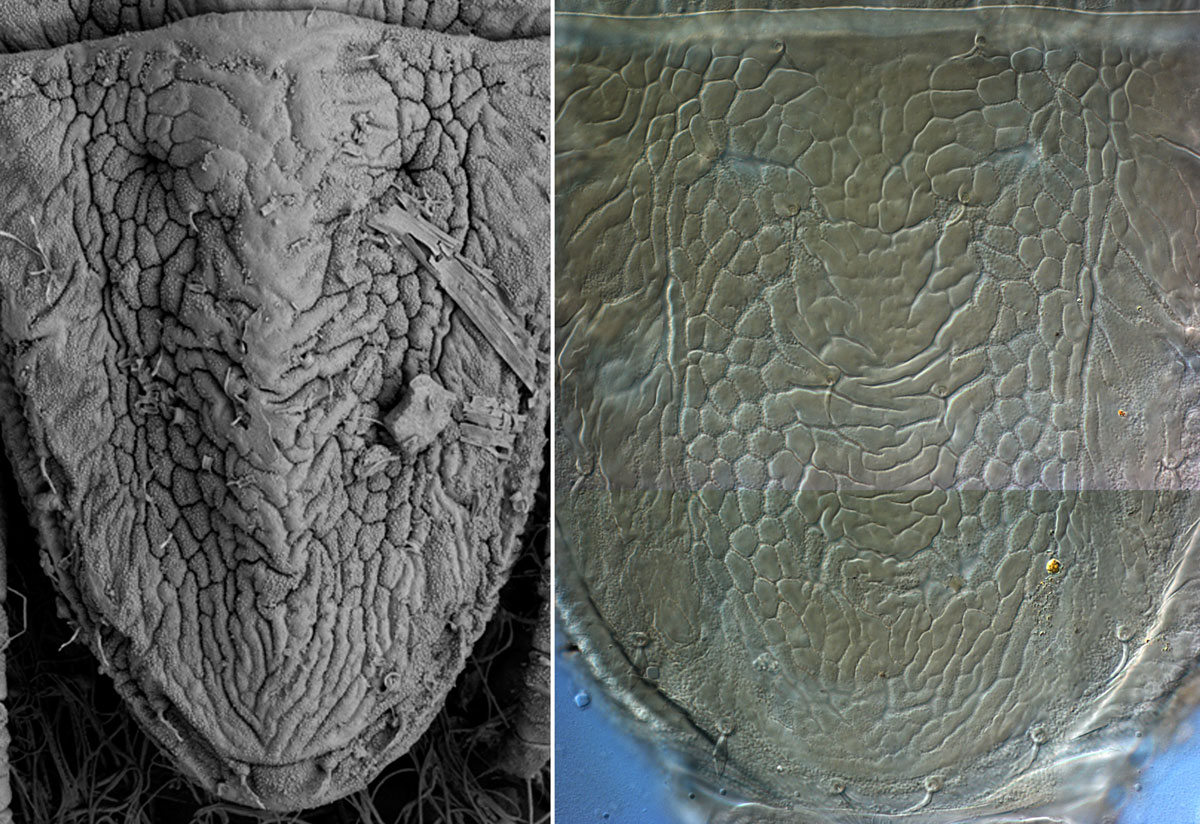 Figure 4a (left): real life appearance in LTSEM image, Figure 4b (right) body shape altered during slide mounting