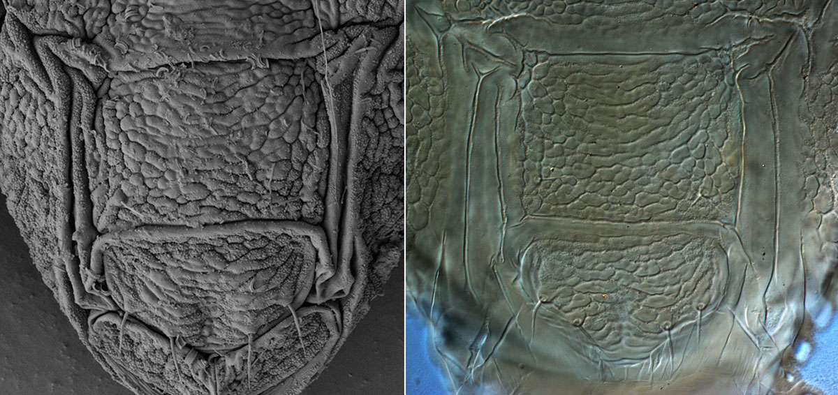 Figure 5a (left): real life appearance in LTSEM image, Figure 5b (right) body shape altered during slide mounting