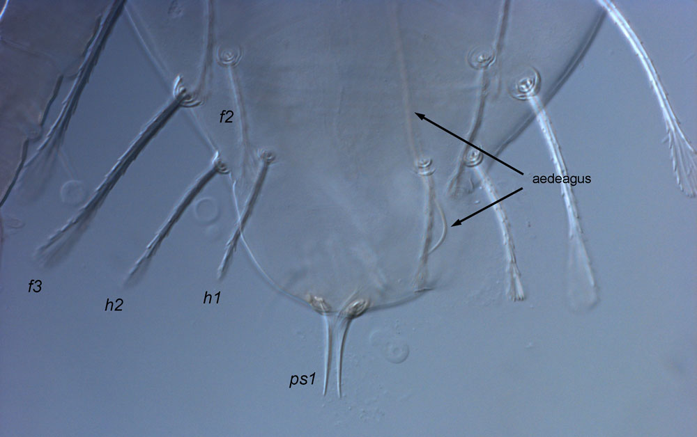 Figure 10: male Raoiella with aedeagus