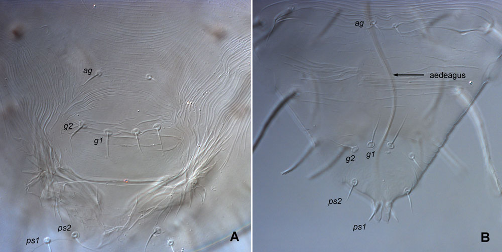 Figure 11: female (a) and male (b) Raoiella posterior venter