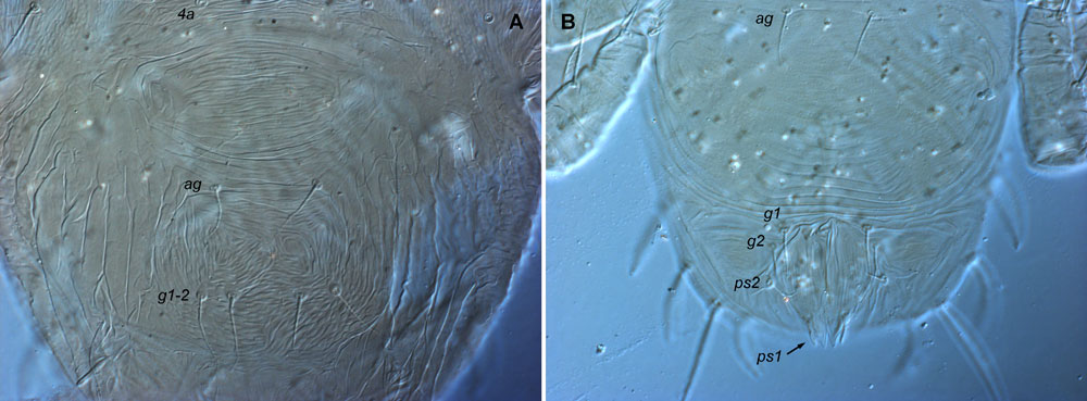 Figure 13: female (a) and male (b) Tenuipalpus posterior venter
