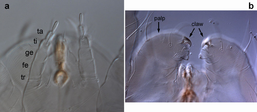 Figure 5: palps without (5a) and with (5b) claws on the second last segment