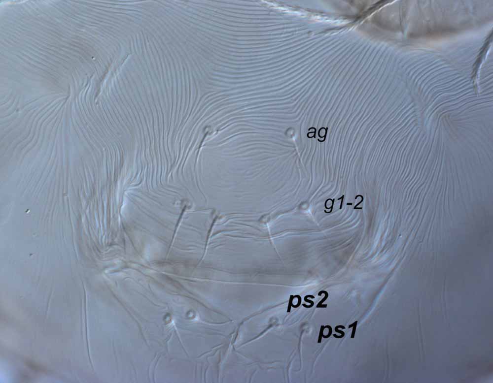            Fig. 8.   Raoiella  sp. female posterior venter,   with detail of genital region.   