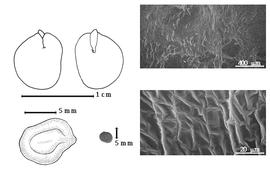  Seed, cotyledon, embryo, and testa:  A. patens  (W.J. Hooker amp; G.A.W. Arnott) J.P.M. Brenan - top left cotyledon concealing all but radicle tip (L) and embryonic axis (R), bottom left seed topography, bottom left center seed, testa SEMs.
