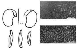  Cotyledon, embryo, and testa:  B. sericea  M. Micheli - embryo, cotyledons, and testa SEMs.
