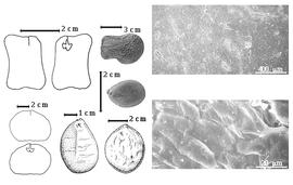  Seed, cotyledon, embryo, and testa:  B. coriacea  Keay - bottom center seed topography;  B. grandiflora  (M.H. Vahl) Hutchinson amp; Dalziel - bottom left center seed topography, center seed;  B.  spp. - top far left and bottom far left cotyledons split and concealing radicle (above or left) and embryonic axes (below or right), top left center seed, testa SEMs.
