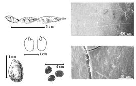  Seed, cotyledon, embryo, and testa:  C. oreothauma  Hillcoat, Lewis amp; Verdcourt - left top fruit;  C. siliqua  C. Linnaeus - left center cotyledon auriculate over margin of radicle (L) and embryonic axis (R), bottom far left seed topography, bottom left center seeds, testa SEMs.
