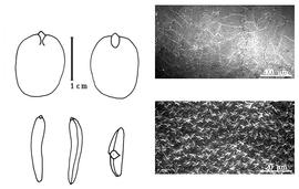  Cotyledon, embryo, and testa:  H. occidentalis  (T.S. Brandegee) R.C. Barneby amp; J.W. Grimes - embryo, cotyledons, and testa SEMs.
