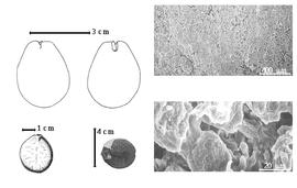  Seed, cotyledon, embryo, and testa:  I. angolensis  (F.M.J. Welwitsch ex G. Bentham) A.C. Hoyle amp; J.P.M. Brenan - bottom left center seed, testa SEMs;  I. scheffleri  (H.A.T. Harms) Greenway - bottom far left seed topography, top left cotyledon notched and split concealing all but tip of radicle (L) and embryonic axis (R).
