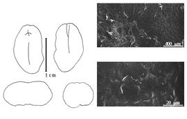  Cotyledon, embryo, and testa:  P. xylophylloides  (J.G. Baker) D.J. Du Puy, J.-N. Labat amp; B.D. Schrire - embryo, cotyledons, and testa SEMs.
