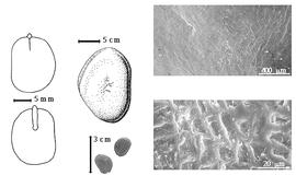 Seed, cotyledon, embryo, and testa:  P. emarginatus  (Hutchinson amp; Dalziel) J.J.G. Léonard - far left cotyledon notched and split and concealing all but tip of radicle (above) and embryonic axis (below), top left center seed topography, bottom left center seeds, testa SEMs.
