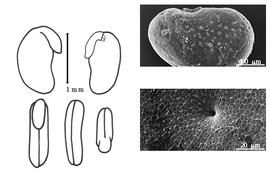  Cotyledon, embryo, and testa:  P. lutescens  (J.L.M. Poiret) A.K. Schindler - embryo, cotyledons, and testa SEMs.

