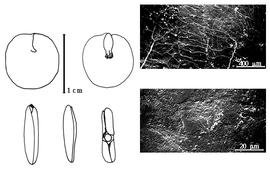  Cotyledon, embryo, and testa:  S. acatlensis  (G. Bentham) R.C. Barneby amp; J.W. Grimes - embryo, cotyledons, and testa SEMs.
