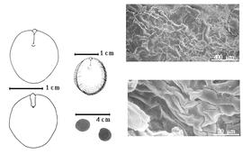  Seed, cotyledon, embryo, and testa:  T. gentii  Hutchinson amp; Greenway - far left cotyledon notched and split and concealing all but tip of radicle (above) and embryonic axis (below), left center seed topography, bottom left center seeds, testa SEMs.

