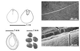  Seed, cotyledon, embryo, and testa:  T. tetraptera  (Schumacher amp; Thonning) P.H.W. Taubert - top left cotyledon concealing all but tip of radicle (L) and embryonic axis (R), bottom left seed topography, bottom center seeds, and testa SEMs.
